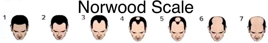 norwood scale image